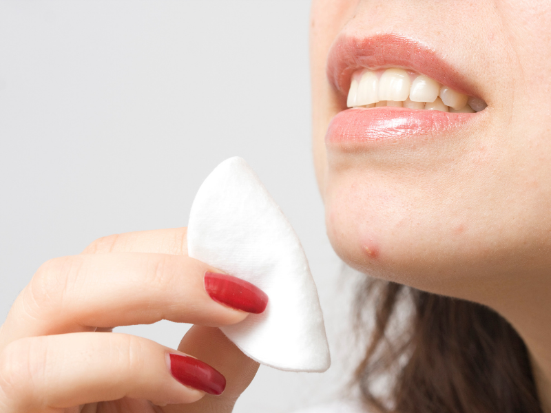 Acne Before Period 8 Ways to Prevent Nannocare