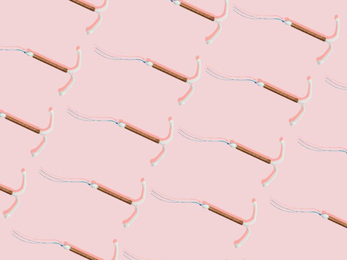 Getting an IUD: What to Expect